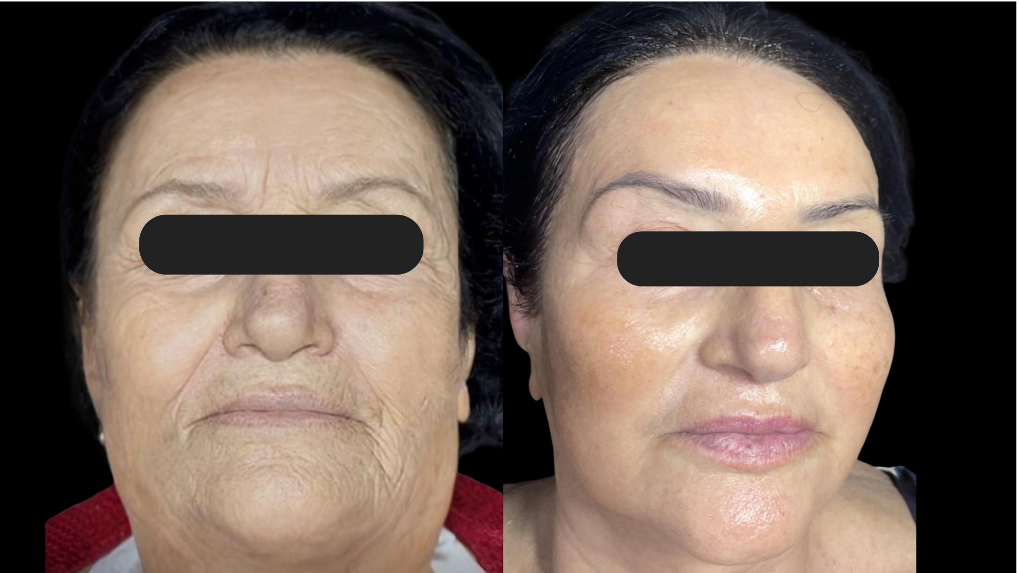 Antes e Depois 1