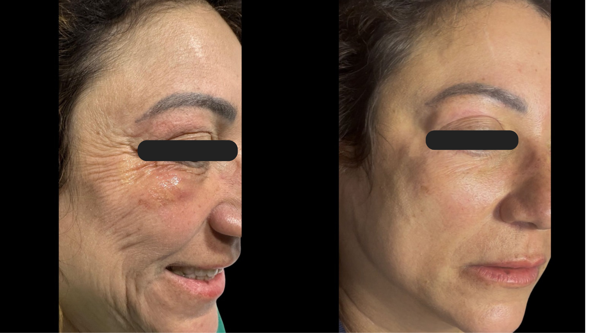 Antes e Depois 3